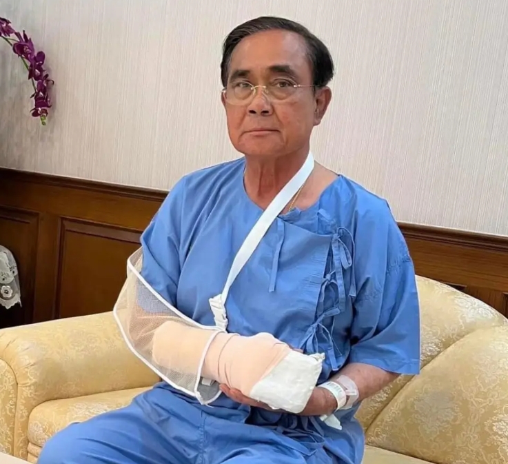 เลขเด็ดนายกป่วยมือบวม